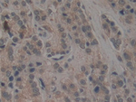 TEP1 Polyclonal Antibody