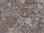 TEP1 Antibody in Immunohistochemistry (Paraffin) (IHC (P))