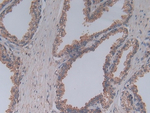 Complement C5a Antibody in Immunohistochemistry (Paraffin) (IHC (P))