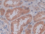 Complement C5a Antibody in Immunohistochemistry (Paraffin) (IHC (P))