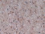 Complement C5a Antibody in Immunohistochemistry (Paraffin) (IHC (P))