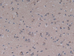 Complement C5a Antibody in Immunohistochemistry (Paraffin) (IHC (P))