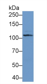 Complement C5a Antibody in Western Blot (WB)