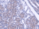 PTPN21 Polyclonal Antibody