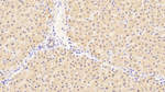 GP130 Antibody in Immunohistochemistry (Paraffin) (IHC (P))