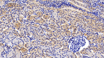 GP130 Antibody in Immunohistochemistry (Paraffin) (IHC (P))