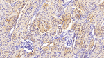 GP130 Antibody in Immunohistochemistry (Paraffin) (IHC (P))