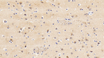 GP130 Antibody in Immunohistochemistry (Paraffin) (IHC (P))