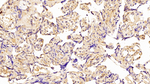 GP130 Antibody in Immunohistochemistry (Paraffin) (IHC (P))