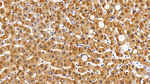 GP130 Antibody in Immunohistochemistry (Paraffin) (IHC (P))