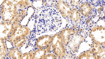 GP130 Antibody in Immunohistochemistry (Paraffin) (IHC (P))