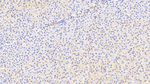 SLC25A37 Polyclonal Antibody