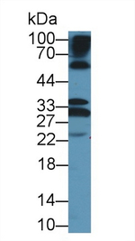 Keratocan Antibody in Western Blot (WB)