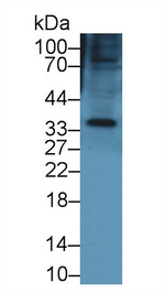 Keratocan Polyclonal Antibody