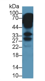 Keratocan Antibody in Western Blot (WB)