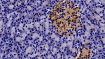 Prolactin Receptor Antibody in Immunohistochemistry (Paraffin) (IHC (P))
