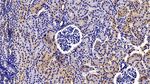 Prolactin Receptor Antibody in Immunohistochemistry (Paraffin) (IHC (P))