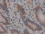 Prolactin Receptor Antibody in Immunohistochemistry (Paraffin) (IHC (P))