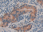 Prolactin Receptor Antibody in Immunohistochemistry (Paraffin) (IHC (P))