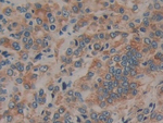Prolactin Receptor Antibody in Immunohistochemistry (Paraffin) (IHC (P))