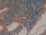 Prolactin Receptor Antibody in Immunohistochemistry (Paraffin) (IHC (P))