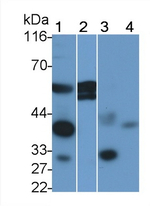 Prolactin Receptor Antibody in Western Blot (WB)