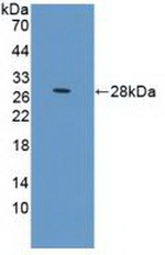 Prolactin Receptor Antibody in Western Blot (WB)