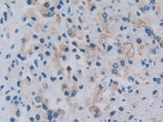 RARS Antibody in Immunohistochemistry (Paraffin) (IHC (P))