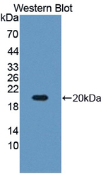RARS Antibody in Western Blot (WB)