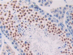 PNOC Antibody in Immunohistochemistry (Paraffin) (IHC (P))