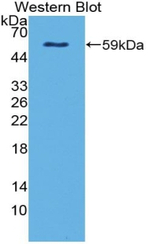 NTN4 Antibody in Western Blot (WB)