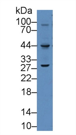 VEGFC Antibody in Western Blot (WB)