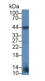 VEGFC Antibody in Western Blot (WB)