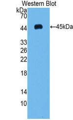 VEGFC Antibody in Western Blot (WB)