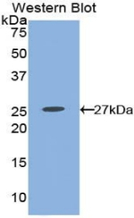 PTGER2 Antibody in Western Blot (WB)