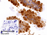 Cathepsin L Antibody in Immunohistochemistry (Paraffin) (IHC (P))