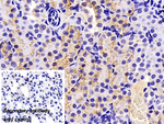 Cathepsin L Antibody in Immunohistochemistry (Paraffin) (IHC (P))