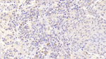 BAFF Receptor (CD268) Antibody in Immunohistochemistry (Paraffin) (IHC (P))