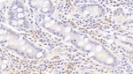 BAFF Receptor (CD268) Antibody in Immunohistochemistry (Paraffin) (IHC (P))