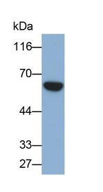 Asparagine Synthetase Antibody in Western Blot (WB)
