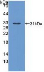 PLCE1 Antibody in Western Blot (WB)