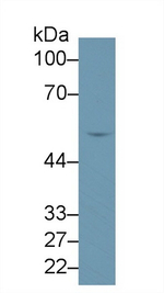 ALDH1B1 Antibody in Western Blot (WB)