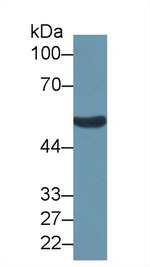 ALDH1B1 Antibody in Western Blot (WB)