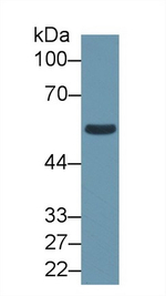 ALDH1B1 Antibody in Western Blot (WB)