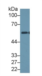 ALDH1B1 Antibody in Western Blot (WB)