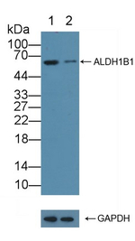 ALDH1B1 Antibody in Western Blot (WB)