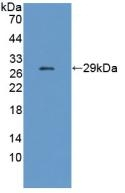 CHRNE Antibody in Western Blot (WB)