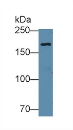 EPRS Antibody in Western Blot (WB)