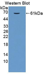 EPRS Antibody in Western Blot (WB)