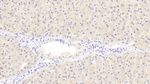 COQ10B Polyclonal Antibody